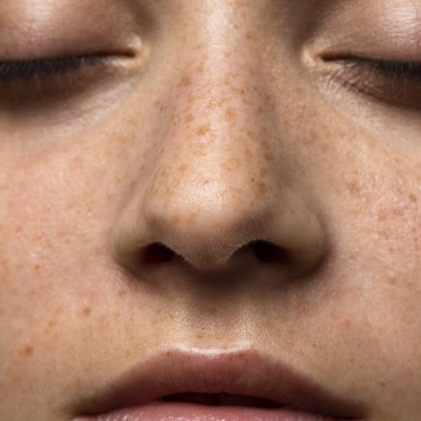 vue-face-jeune-femme-texture-peau